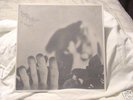 RESIDENTS FINGERPRINCE 1 OF 1000 PRESSED