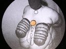 HARDCORE - HORDE LIQUIDE 02 LA PESTE - Ltd 150 copies 