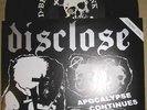 DISCLOSE ACEP DISCHARGE BROKEN BONES ANTI CIMEX MOB 47