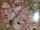 ACCIDENTAL SUICIDE Deceased LP AUTOPSY CARCASS DEATH