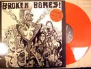 BROKEN BONES LPCV DISCHARGE VARUKERS DISCLOSE WOLFPACK