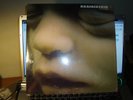 RAR LP 33