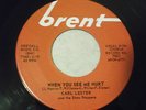 CARL LESTER & THE SHOW STOPPERS / WHEN YOU SEE ME HURT / AMAZING NORTHERN SOUL