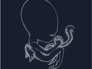 Sigur Ros - Ágætis Byrjun - 2LP + print - Agaetis - Fat Cat original pressing -