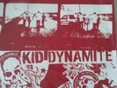 Kid Dynamite TIHC Double LP Lifetime None More Black