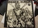 BROKEN BONES 
