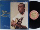 SKIP JAMES Today VANGUARD LP SHRINK
