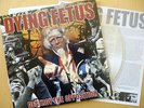 DYING FETUS Destroy The Opposition LP/ Devourment Cannibal Corpse Brodequin