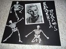 RONNIE DAWSON --ROCKIN BONES--- FIRST L/P ON NO HIT RECORDS -- 001