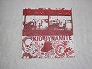 Kid Dynamite This Is Hardcore 2010 Red Cover #63/300 Gorilla Biscuits Rival Mob