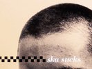 V/A 