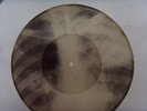 LESCHENKO Bones'n'ribs X-RAY roentgen film roentgenizdat record USSR 1950s orig