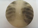 Amado Mio (Geraldo?) Bones'n'ribs X-RAY roentgen film roentgenizdat 1950s USSR