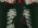 Aorta NEAR MINT CBS Vinyl LP
