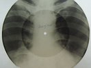 LECUONA CUBAN BOYS Rumba-Negra X-RAY roentgen film roentgenizdat bones record