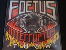 Foetus Interruptus 