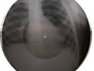 Bones'n'ribs X-Ray Audio roentgen film roentgenizdat 1950s 