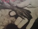 Dead Kennedys ?– Plastic Surgery Disasters Vinyl LP Manifesto NEW/SEALED