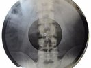 X-Ray Audio roentgen film Record Bones Ribs 50s Jazz 