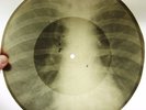 X-Ray 78rpm LESHCHENKO Chubchik RARE USSR AUDIO ROENTGEN FILM Ribs Bones 1950s
