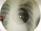 X-Ray 78rpm LESHCHENKO You came back Tango RARE USSR ROENTGEN Ribs Bones 1950s