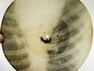 X-Ray 78rpm PETER LESHCHENKO Blue Eyes Tango RARE USSR ROENTGEN Ribs Bones 1950s