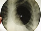 X-Ray 78rpm PETER LESHCHENKO Miranda Tango RARE USSR ROENTGEN Ribs Bones 1950s