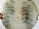 X-Ray 78rpm SOKOLSKY Tear Drops Tango RARE USSR ROENTGEN Ribs Bones Thorax 1950s