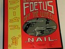Foetus 