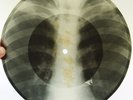 X-Ray 78rpm YURIEVA YURYEVA Forgive Me Tango RARE USSR ROENTGEN Ribs Bones 1950s