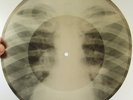 X-Ray 78rpm LESHCHENKO Skutchno Boring Tango RARE USSR ROENTGEN Ribs Bones 1950s