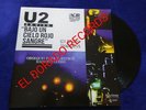 U2 