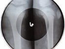 X-Ray Audio roentgen film Record Bones Ribs 50s Leshchenko 