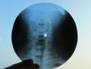 X-ray unidentified record Rock Bones Ribs vinyl