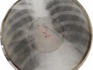X-Ray Audio roentgen film Record Bones Ribs 50s Leschenko Studentochka, Tango