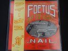 Foetus 