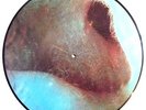 PINK FLOYD LP VINYL - meddle - PICTURE DISC