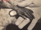 Dead Kennedys Plastic Surgery Disasters VINYL LP FIRST EDITION Virus 27 Booklet