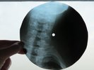Record Bones Ribs X ray Non identified Rock
