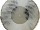 X-Ray Audio roentgen film Record Bones Ribs 1950s Leshchenko 