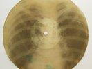 X-Ray 78rpm LESHCHENKO Lola Tango RARE USSR AUDIO ROENTGEN Ribs Bones Thorax