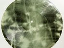 X-Ray 78rpm LESHCHENKO Blue eyes Tango RARE USSR AUDIO ROENTGEN FILM Ribs Bones