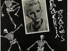 Ronnie Dawson - Rocking Bones LP - No Hit UK VG+