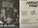 Agnostic Front United Blood EP 35th Anniversary Edition gorilla biscuits judge