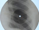 USSR GEORGIAN X-RAY ROENTGEN BONES RIBS 8