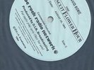 David Bowie King Biscuit Flower Hour Radio Show 2LP Montreal 1983