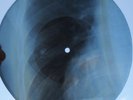BEATLES - TWIST AND SHOUT  UNIQUE USSR GEORGIAN X-RAY ROENTGEN BONES RIBS RECORD