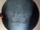 ROLLING STONES - LAST TIME - UNIQUE USSR GEORGIAN X-RAY ROENTGEN SKULL RECORD