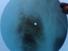 ELVIS PRESLEY - DEVIL IN DISGUISE - UNIQUE USSR X-RAY ROENTGEN RIBS BONES RECORD
