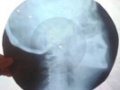 Chuck Berry - Johnny B. Goode - X-RAY - USSR ROENTGEN BONES RECORD - Skull 9